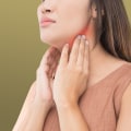 Understanding Swollen Lymph Nodes